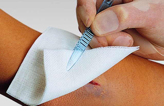 Vliwasoft Vliesstoffkompressen 10x20cm 4-lagig steril 75 x 2 Stk