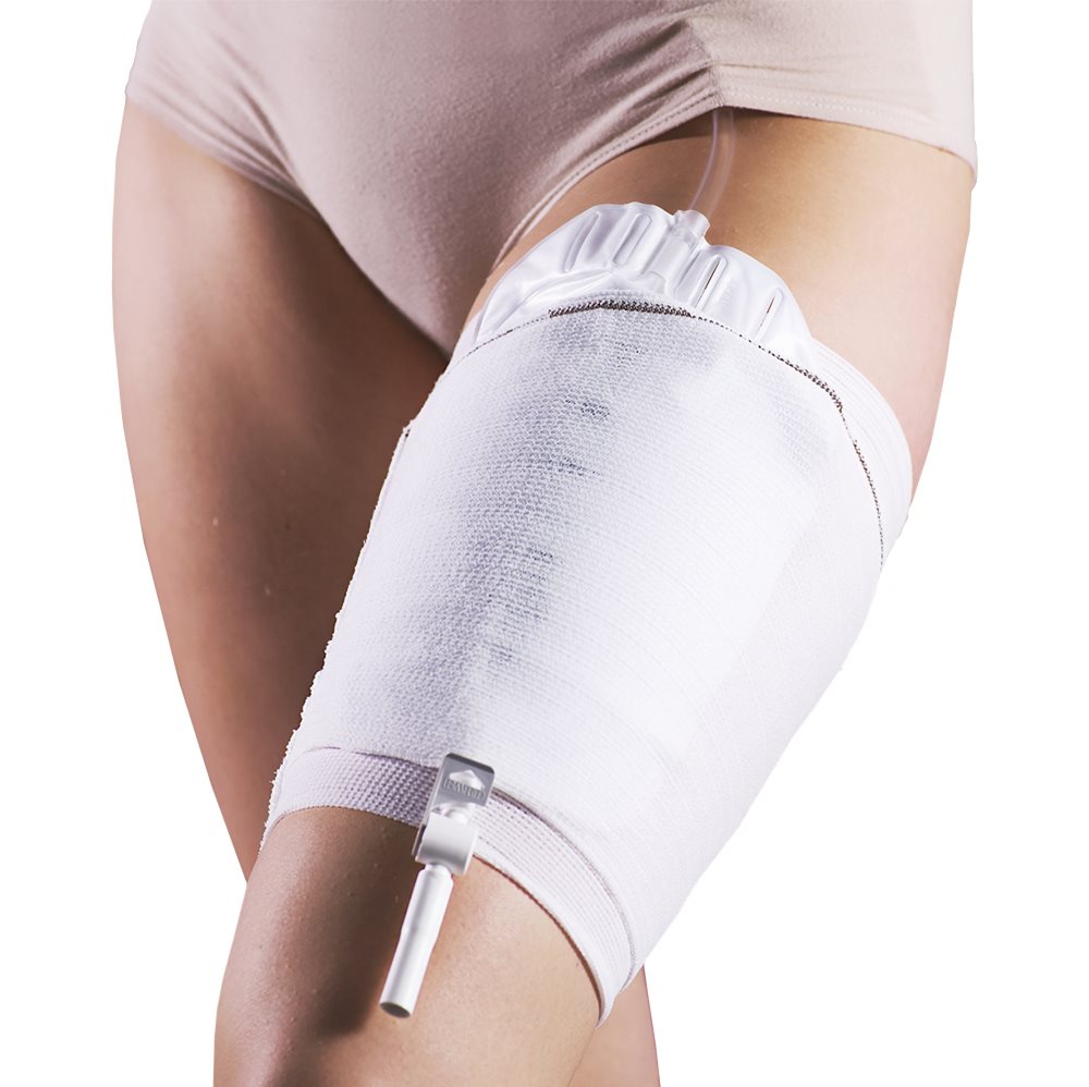 CAREFIX Beinbeutelfixierung, Bild 2 von 2