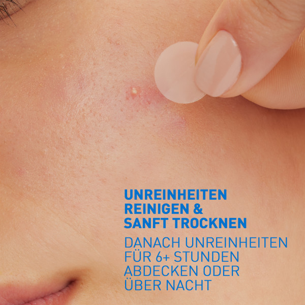 CERAVE Patches Anti-Imperfections, image 3 sur 5