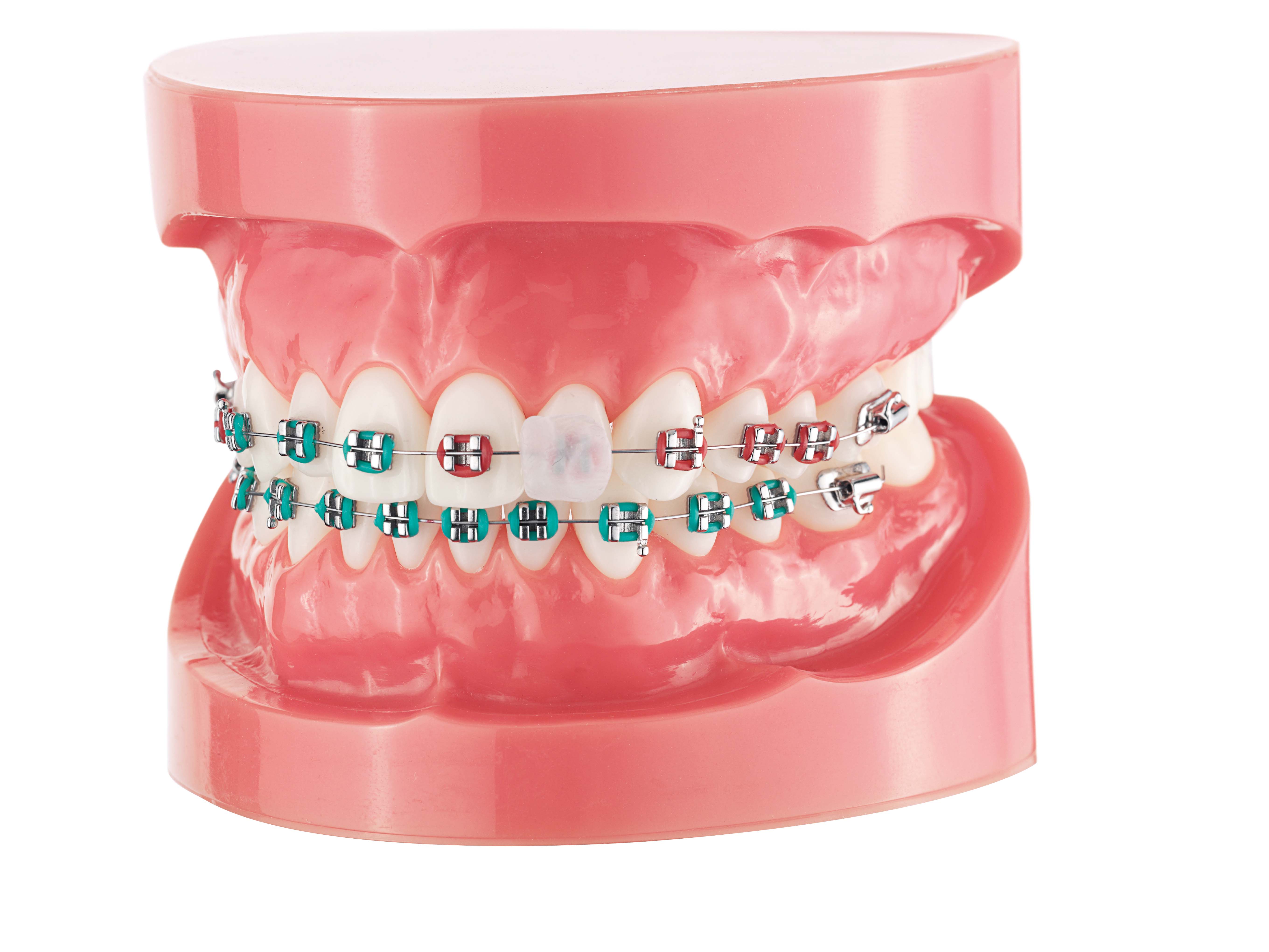 CURAPROX Orthodontischer Wachs, Bild 4 von 4