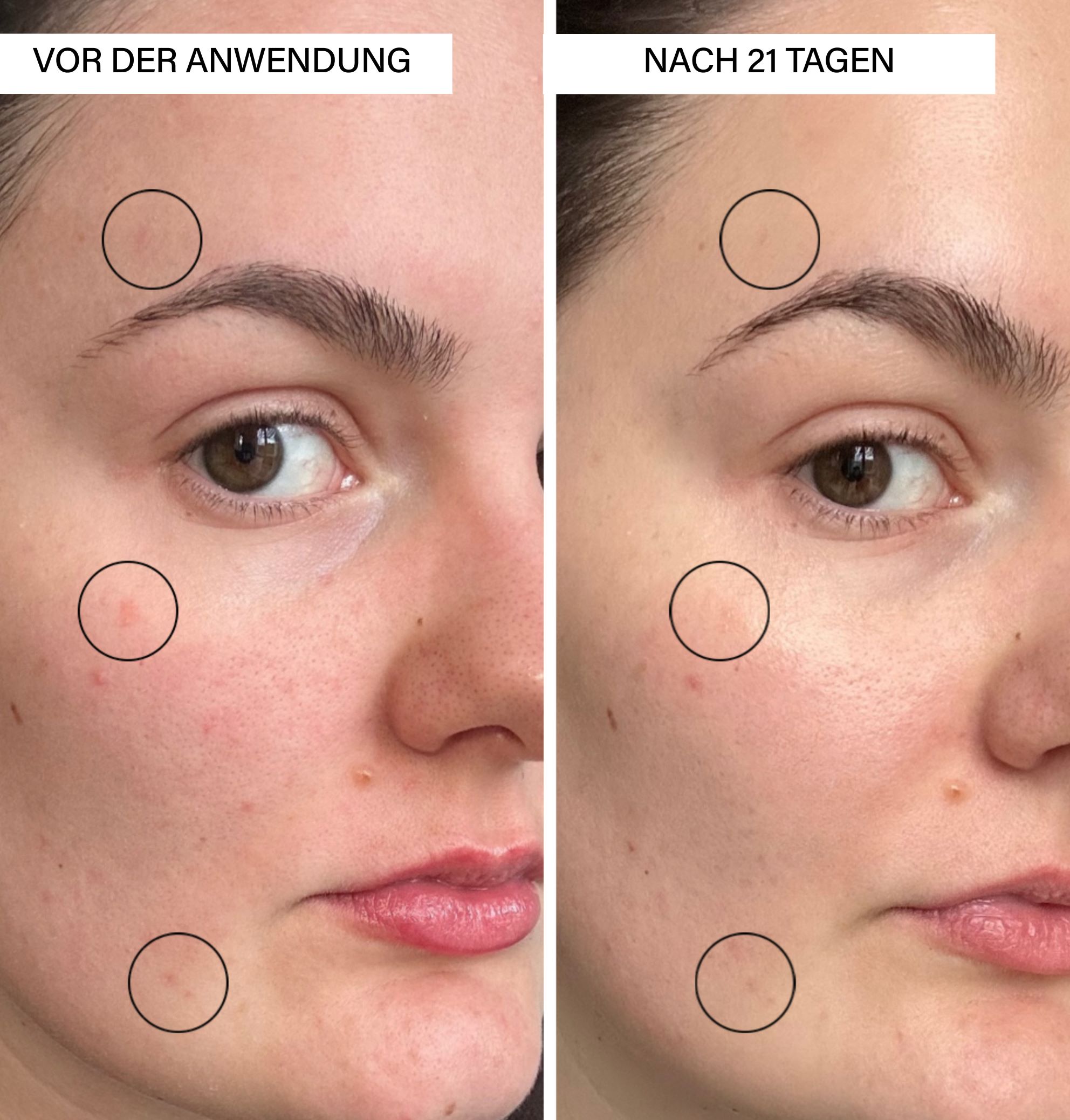 ROSENTAL brightening serum, image 5 sur 5
