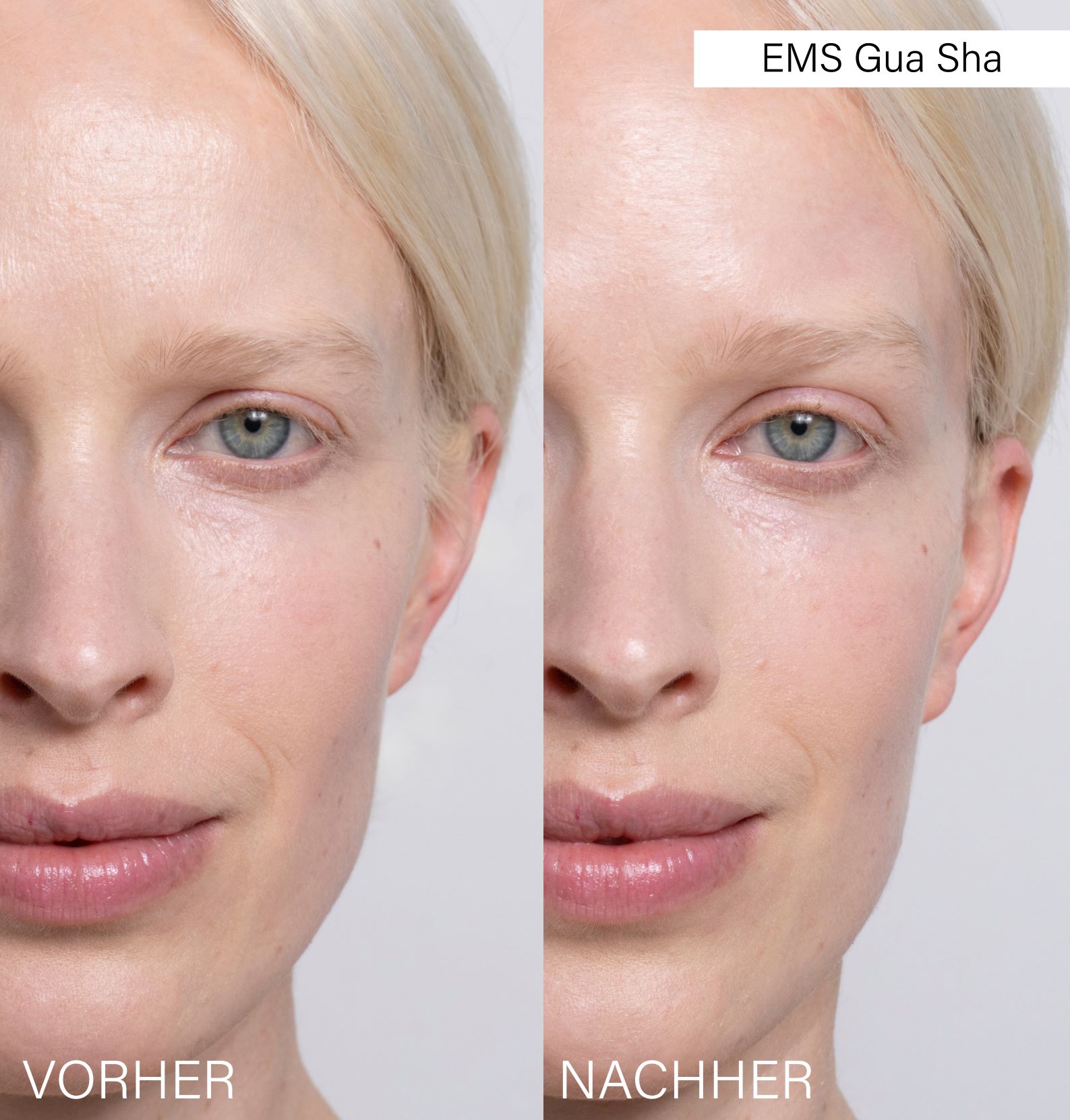 ROSENTAL EMS Gua Sha, Bild 4 von 5