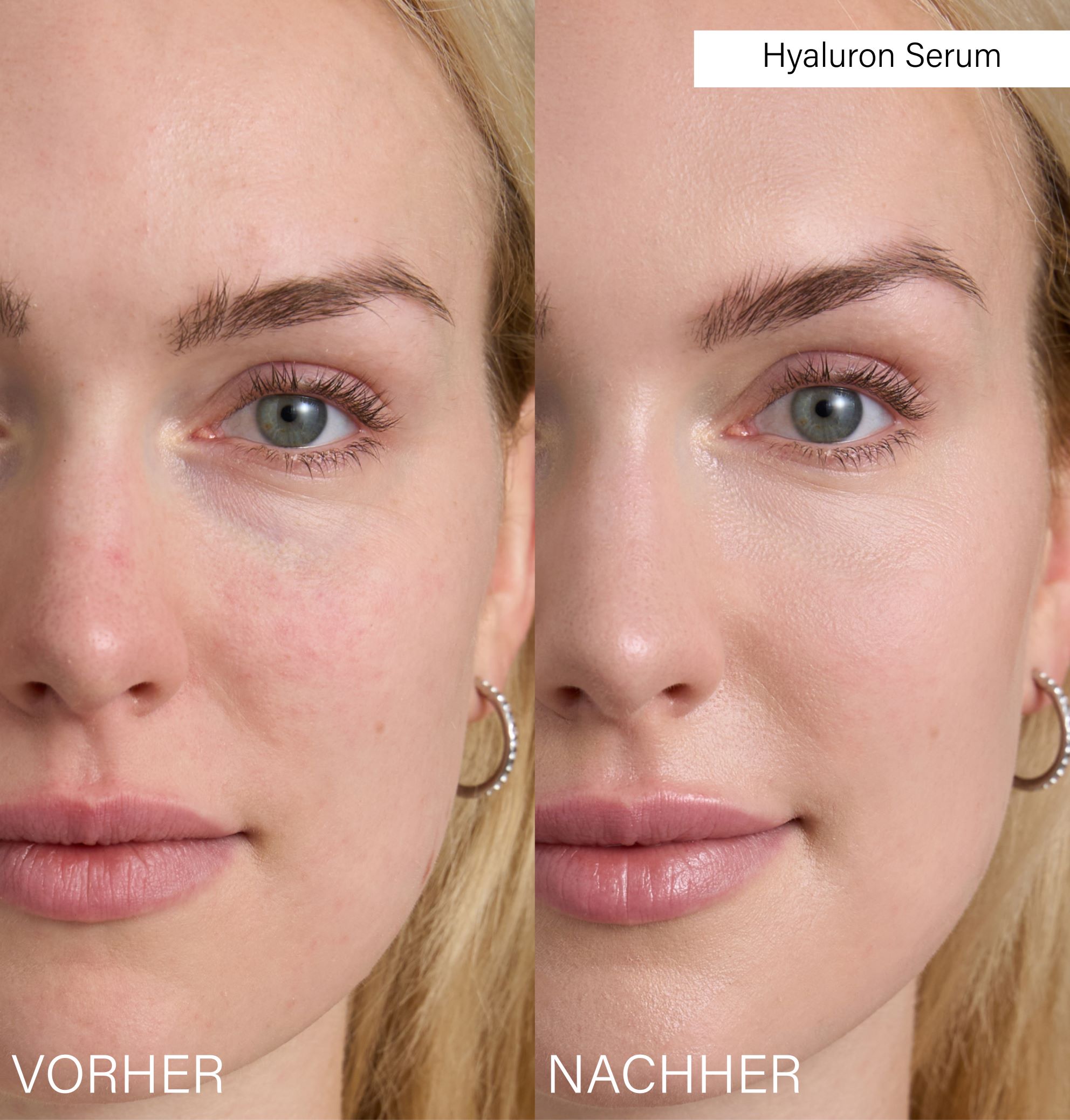 ROSENTAL Hyaluron Serum, Bild 5 von 5
