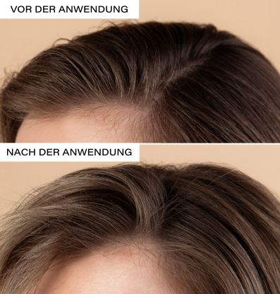 ROSENTAL natural dry shampoo, image 4 sur 5