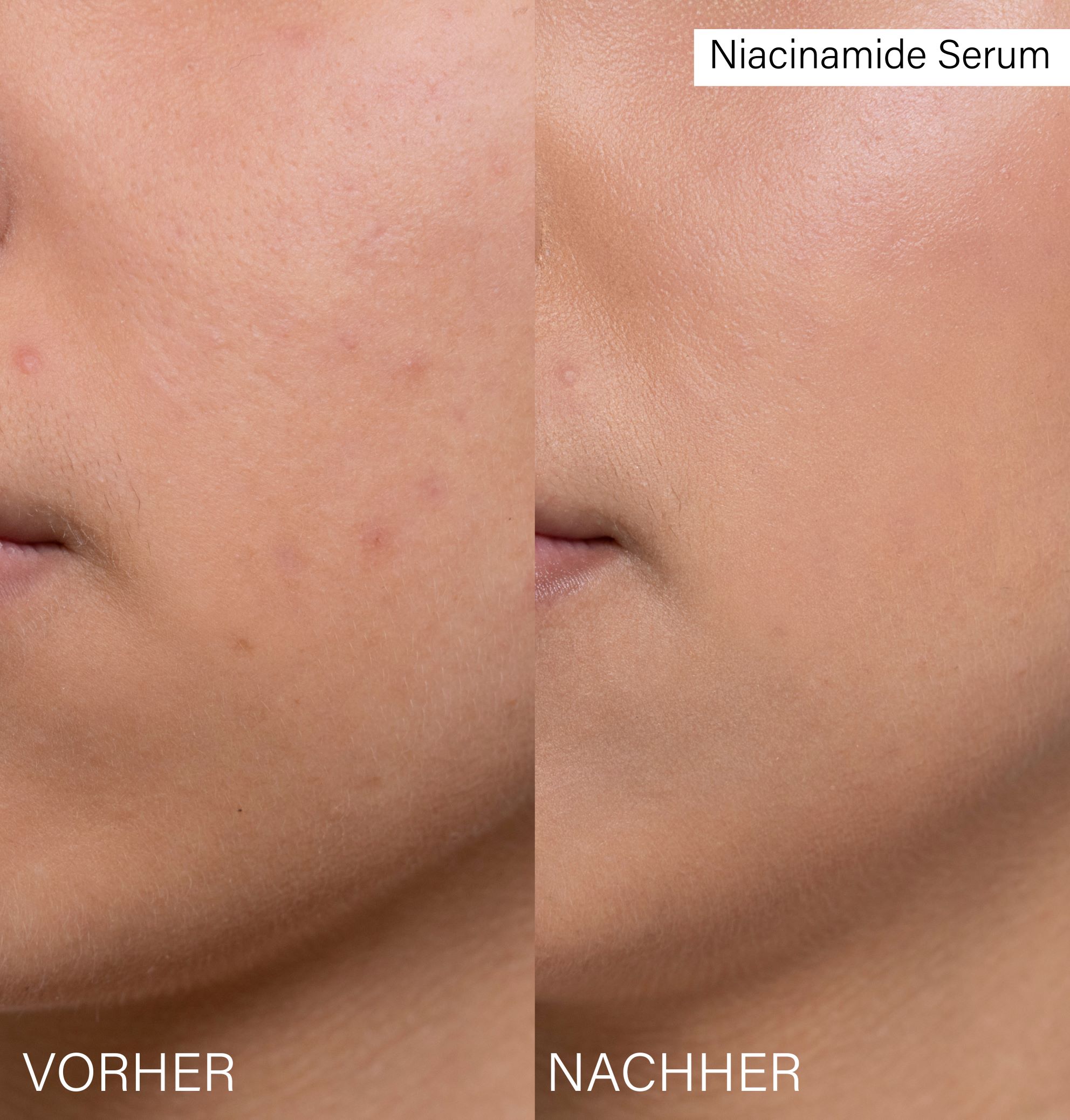 ROSENTAL niacinamide serum, image 5 sur 5