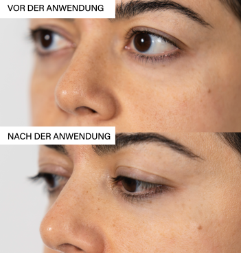 ROSENTAL Skin Exfoliating Peeling, Bild 4 von 5